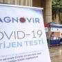 Domestic test, which reduces the diagnosis of Covid-19 to 10 seconds, is available