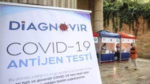 Domestic test, which reduces the diagnosis of Covid-19 to 10 seconds, is available